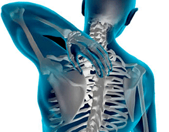 manifestacións de osteocondrose da columna vertebral torácica